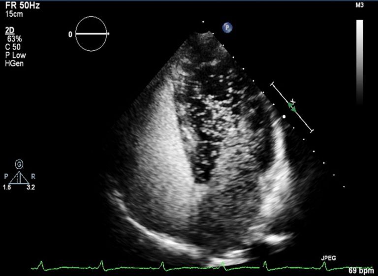 Heart conditions smartcare diagnostics springfield mt gravatt